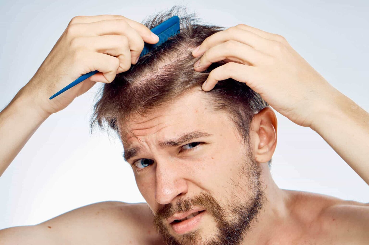 4 Common Causes Of Hair Loss In Men Live Enhanced